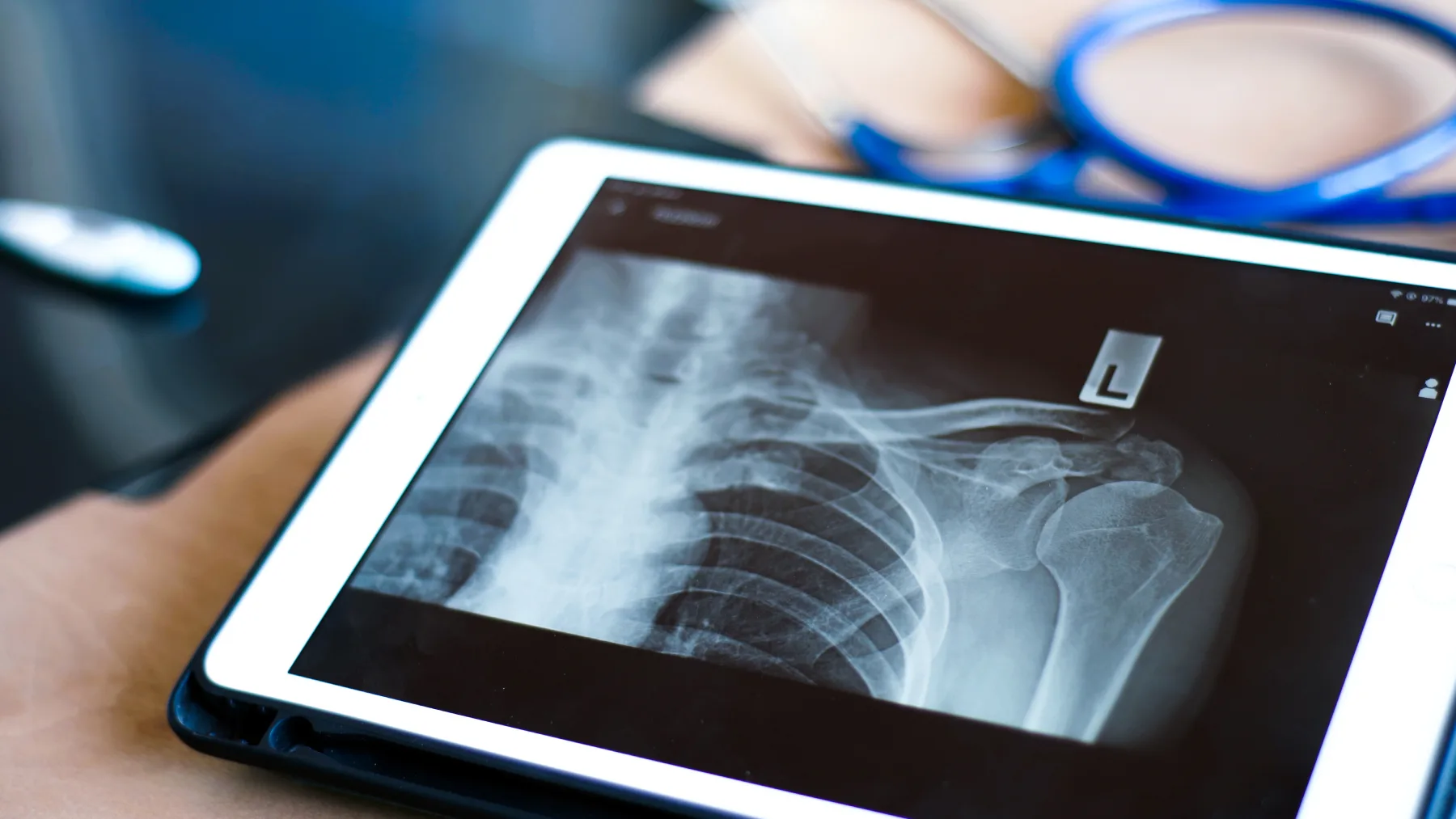 Bone Density (BMD) service