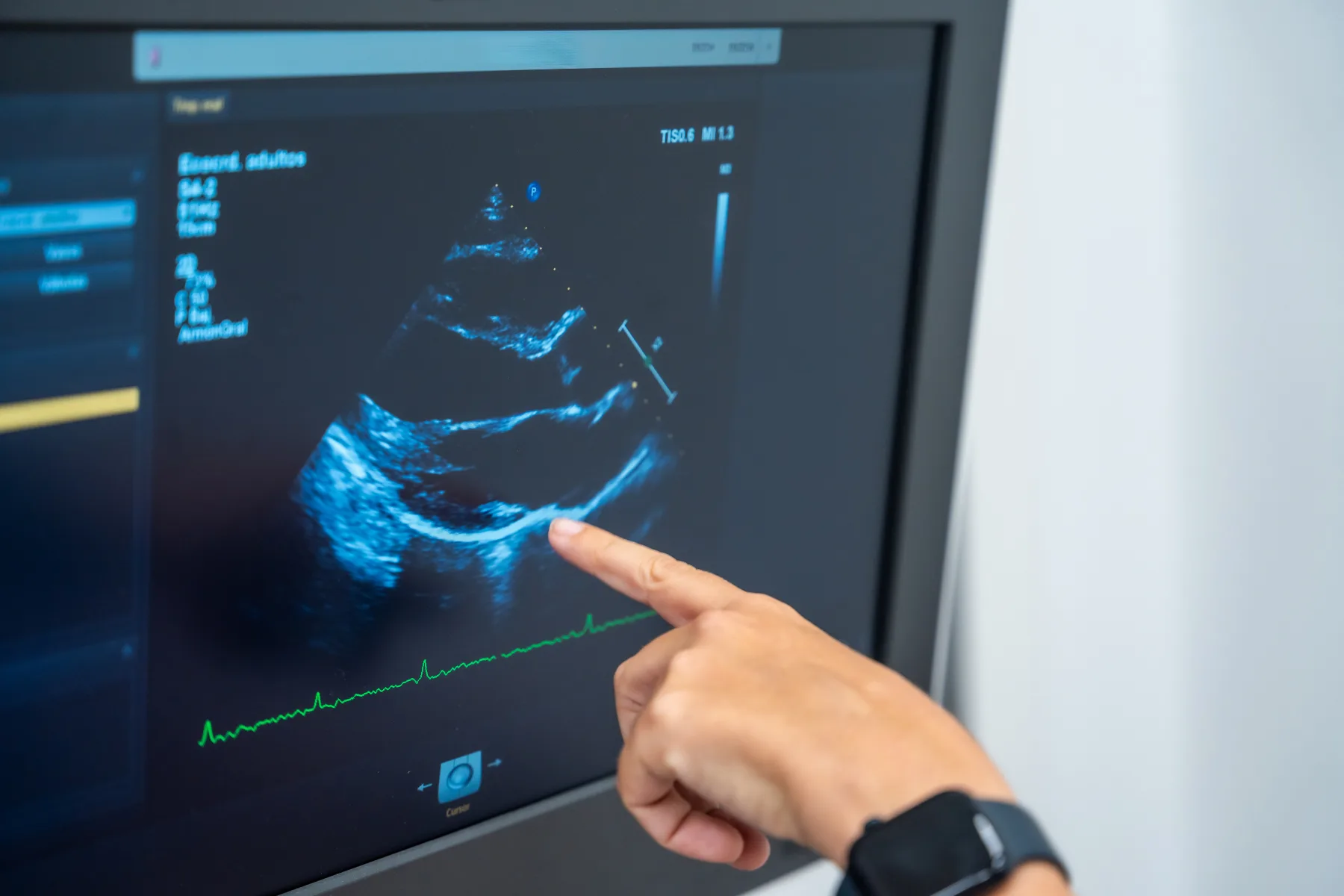 Echocardiography service
