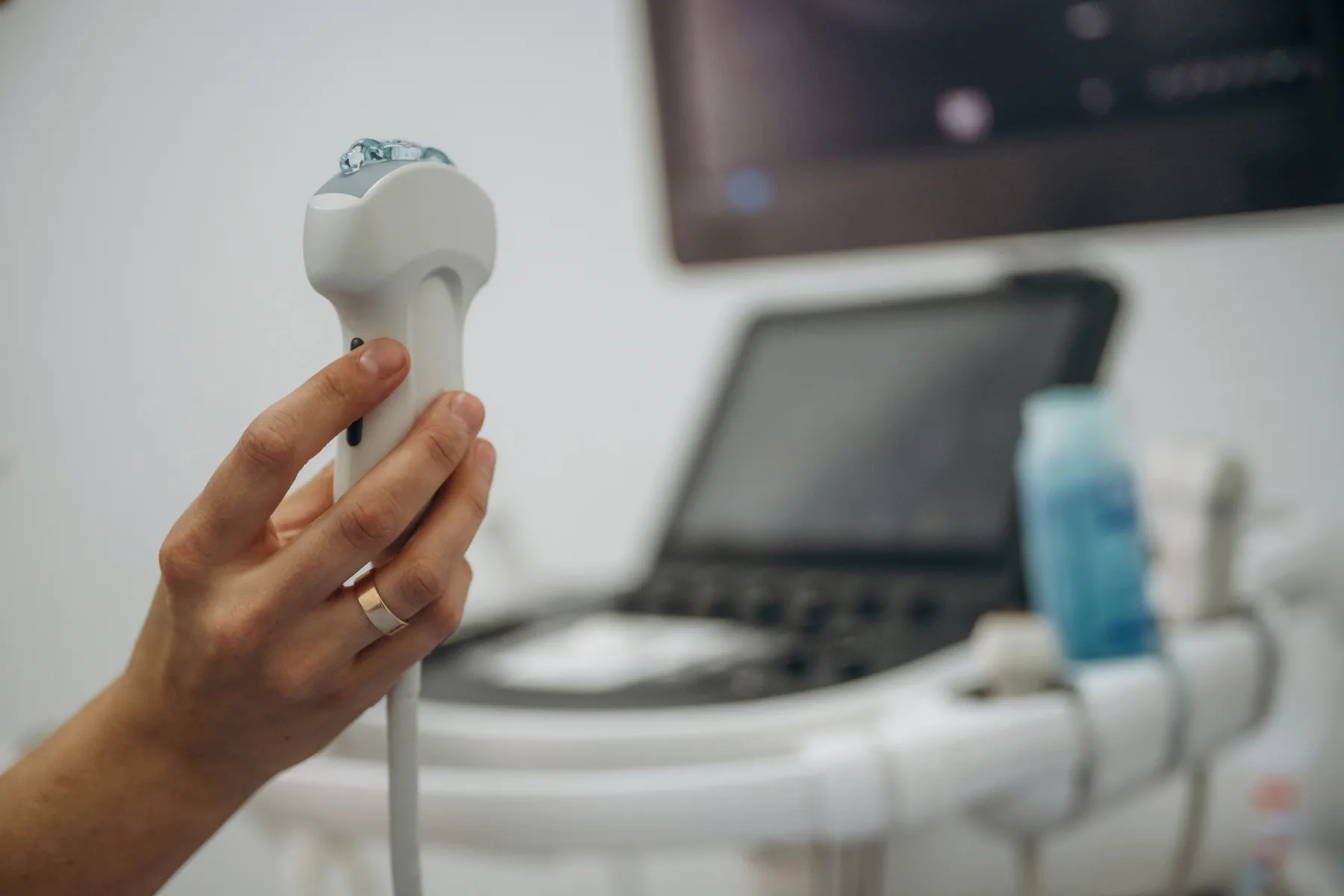 Ultrasound service